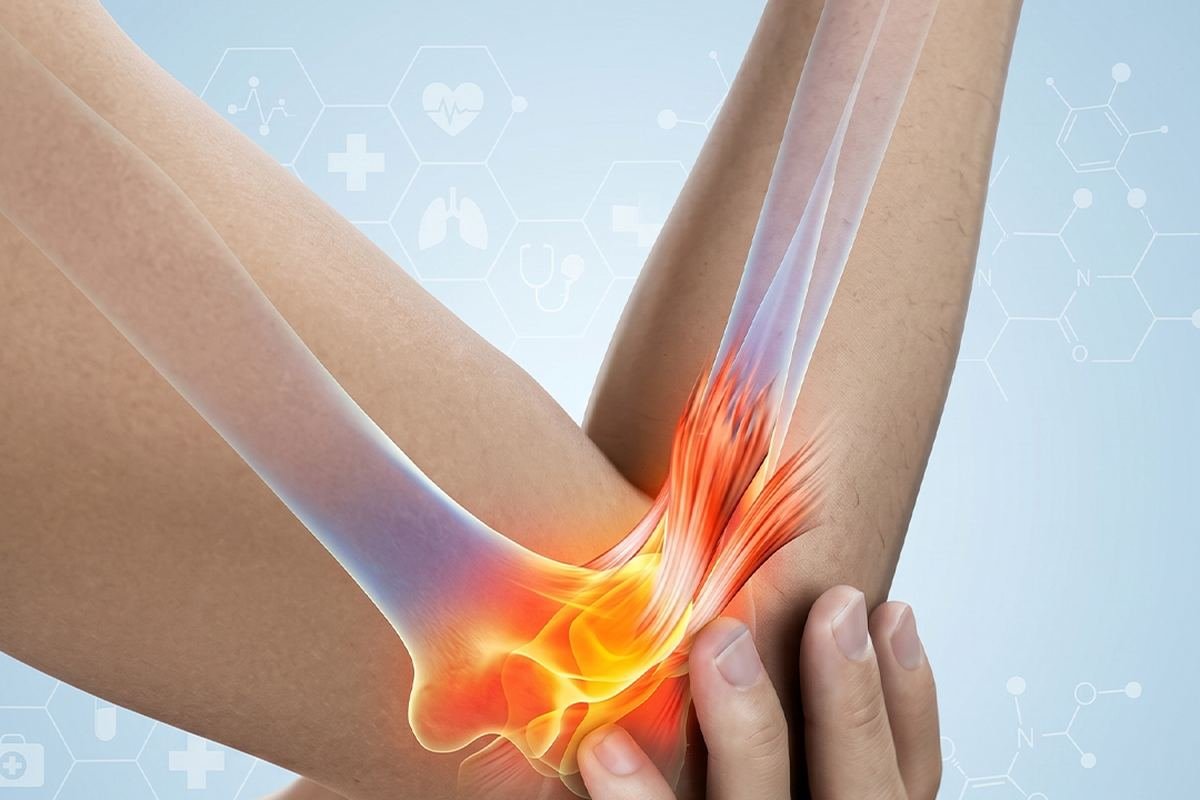 천안 팔꿈치통증·테니스엘보·골프엘보 — 팔꿈치 통증 부위 일러스트